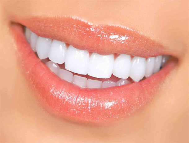 blanchiments-dents-tarifs