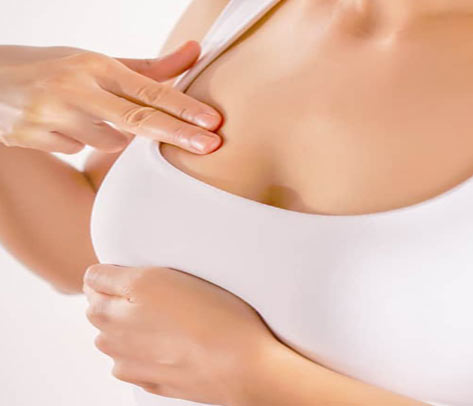 ptose-seins